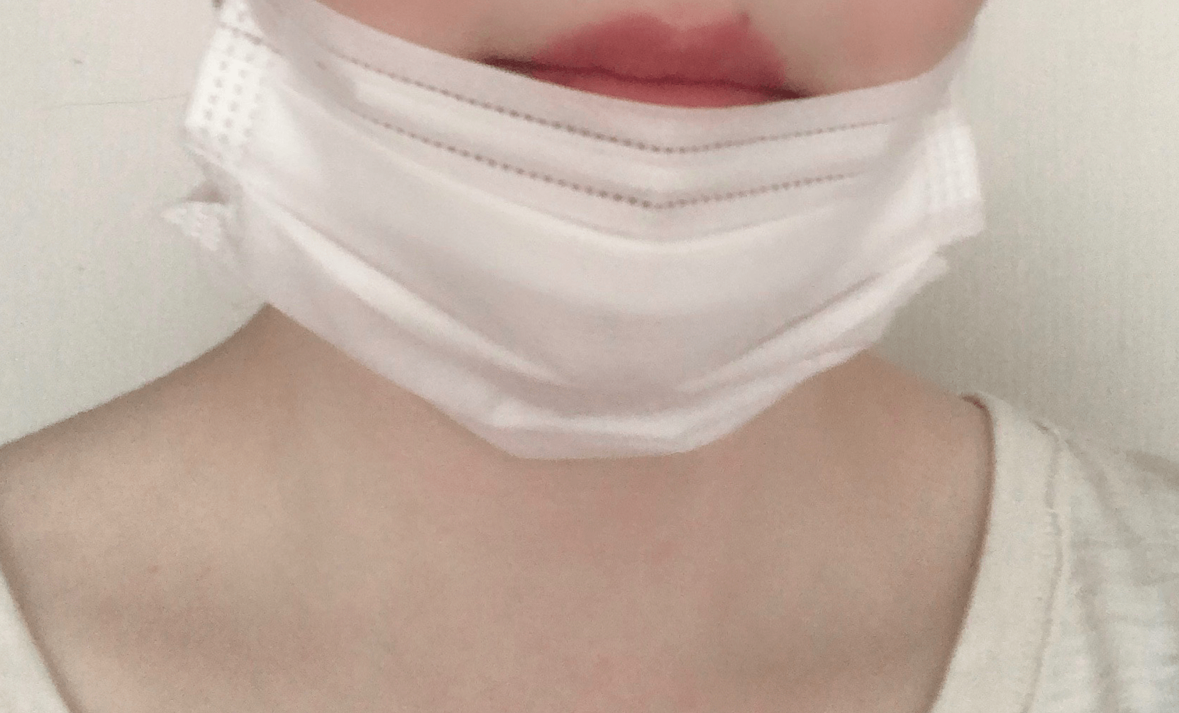 あごニキビ